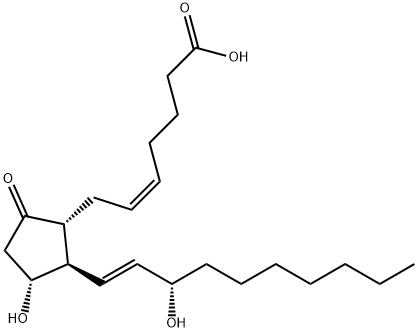 20-?????????E2