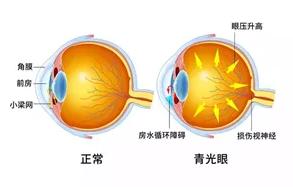 乙酰唑胺與醋甲唑胺有什么不同？