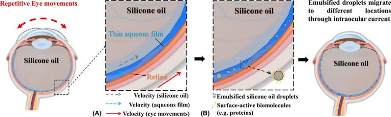 圖2. SO在眼部的乳化過(guò)程。(A)SO與水膜之間的相對(duì)運(yùn)動(dòng)引起剪切應(yīng)力，產(chǎn)生油滴。箭頭的長(zhǎng)度表示速度的大小。(B)油滴由具有表面活性的生物分子穩(wěn)定，如血液成分、蛋白質(zhì)和糖脂，這些分子廣泛存在于眼內(nèi)。.png