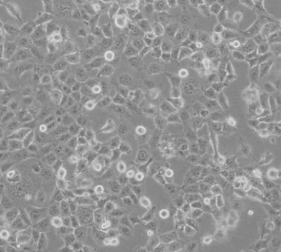 NCI-H2052人惡性胸膜間皮瘤貼壁細胞系的應用