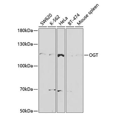OGT抗體的應(yīng)用