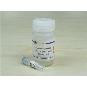 VCP Rabbit Polyclonal Antibody