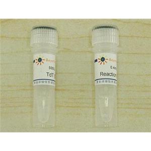 Terminal Deoxynucleotidyl Transferase (20U/μl, 進(jìn)口分裝)