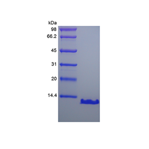 Recombinant Human Parathyroid Hormone 7-8