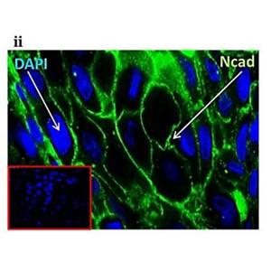 N-CADHERIN 兔多克隆抗體