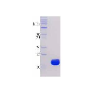 Human acylphosphatase-1