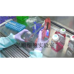 NCI-H660 Cell；人小細(xì)胞癌細(xì)胞