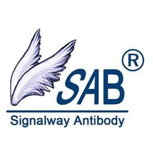 Human anti-trophoblast antibody,ATA ELISA Kit