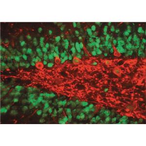 Anti-MMP-2 (Ab-8) Mouse mAb (VB3)