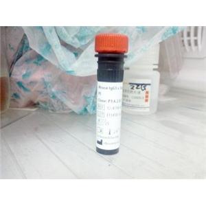 Estrogen Related Receptor gamma peptide (401-413 )