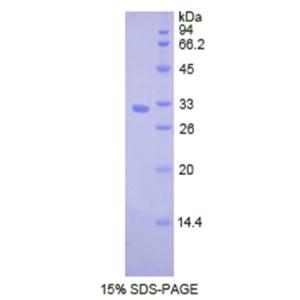 組織蛋白酶V(CTSV)重組蛋白