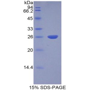 組織蛋白酶S(CTSS)重組蛋白