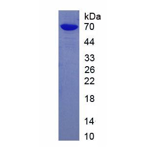 組織蛋白酶E(CTSE)重組蛋白