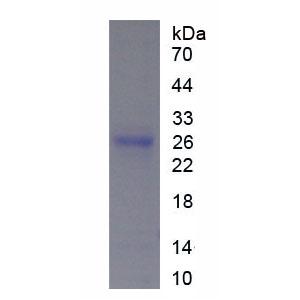 組織蛋白酶B(CTSB)重組蛋白