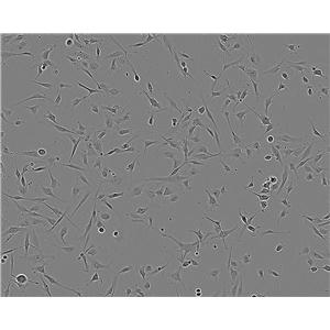 PLA-801D Cell:人高轉(zhuǎn)移肺癌細(xì)胞系