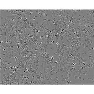 LAPC-4 cell line人前列腺癌細(xì)胞系