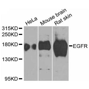 Anti-EGFR Antibody