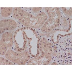 Anti-ACTA2 Rabbit Monoclonal Antibody