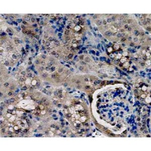 Anti-IL-18 Antibody