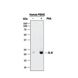 ANTI-HUMAN IL-6