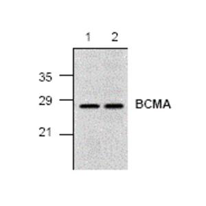 Anti-BCMA 抗體