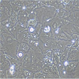 KYSE-150 Fresh Cells|人食管鱗癌細(xì)胞(送STR基因圖譜)