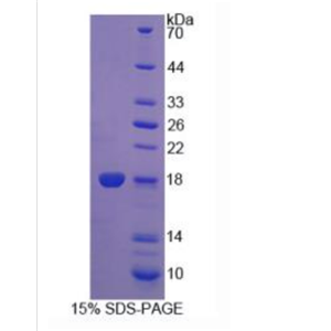 細(xì)胞程序性死亡蛋白5(PDCD5)重組蛋白
