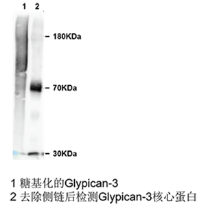 glypican 3小鼠單抗；Anti-Glypican 3 antibody; GPC3 