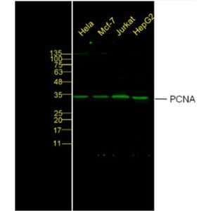 Anti-PCNA-增殖細(xì)胞核抗原抗體