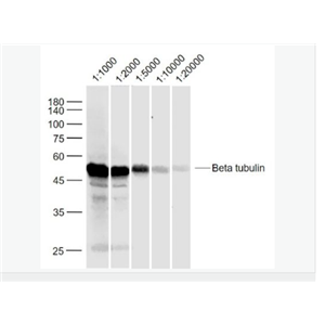 微管蛋白β tubulin/Tubulin β（內(nèi)參）抗體