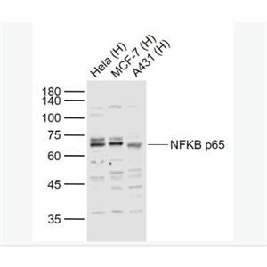 細(xì)胞核因子/k基因結(jié)合核因子抗體
