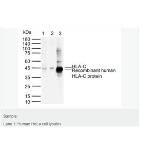 Anti-HLA-C antibody-組織相容性蛋白1單克隆抗體