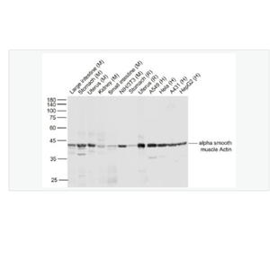 Anti-alpha-肌動蛋白α/α-SMA/α Actin單克隆抗體