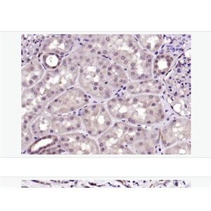 Anti-phospho-AMPK alpha-1-磷酸化腺苷單磷酸活化蛋白激酶α1抗體