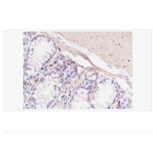 Anti-Calponin-1 antibody-鈣調(diào)節(jié)蛋白-1重組兔單克隆抗體