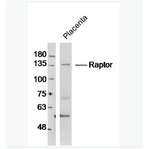 Anti-Raptor antibody-mTOR相關(guān)調(diào)控蛋白抗體