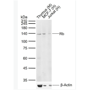 Anti-Rb antibody -成視網(wǎng)膜細胞瘤基因抗體