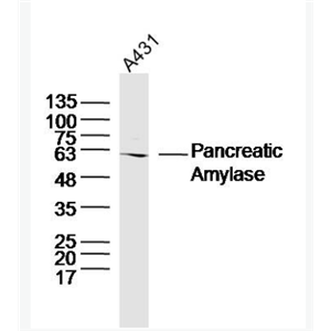 Anti-Pancreatic Amylase antibody -胰淀粉酶抗體