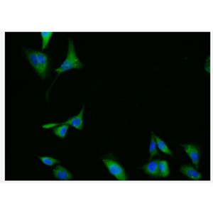 Anti-phospho-ERK1 + 2 (Thr183/Tyr185) antibody-肝細(xì)胞生長因子α抗體