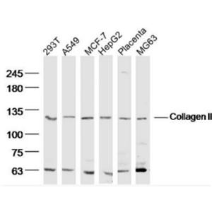 Anti-Collagen II antibody-Ⅱ型膠原α1蛋白/軟骨鈣素抗體