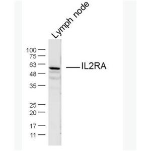 Anti-IL2RA/CD25 antibody-白介素2受體a鏈/IL-2RA抗體