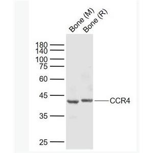 Anti-CCR4 antibody-細(xì)胞表面趨化因子受體4抗體