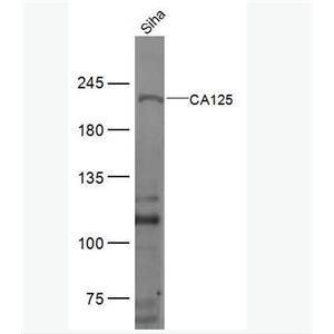 Anti-CA125 antibody-卵巢癌抗原抗體