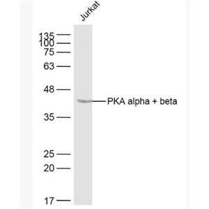 Anti-PKA alpha + beta antibody-蛋白激酶A抗體