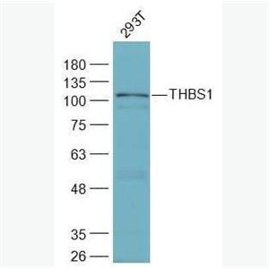 Anti-THBS1 antibody-體超家族成員14抗體