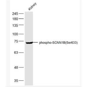 Anti-phospho-SCNN1B (Ser633) antibody-磷酸化上皮鈉通β抗體.