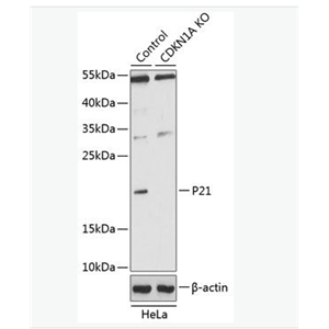 Anti-p21 antibody-p21蛋白抗體