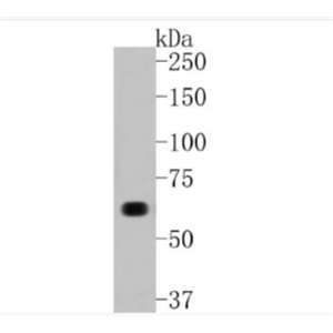 Anti-COL10A1 antibody-COL10A1重組兔單抗