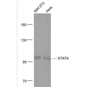 Anti-STAT6 antibody-信號轉(zhuǎn)導和轉(zhuǎn)錄激活因子6重組兔單抗