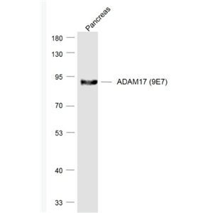 Anti-ADAM17 (9E7) antibody-ADAM17重組兔單抗